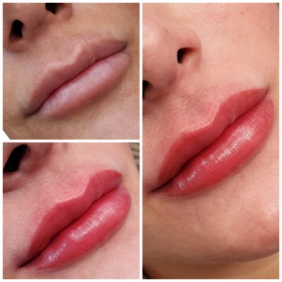 Before and right after lip blush/ lip tint procedure