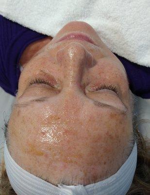 Cranberry Enzyme Facial