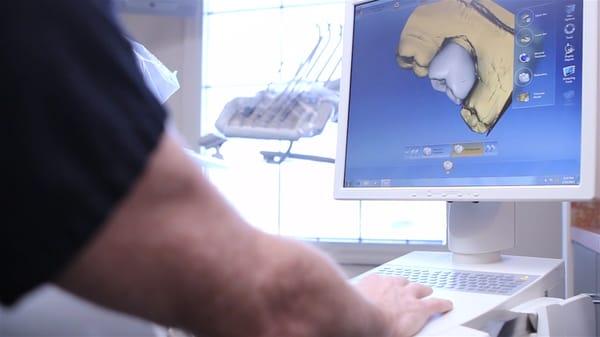 Our Cerec machine allows us to create tooth crowns in one day.