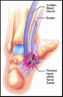 Most foot problems can be treated by Dr. Baize and A Step Ahead Foot & Ankle Clinics