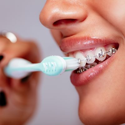 Brushing your teeth is important, but especially if you have braces!