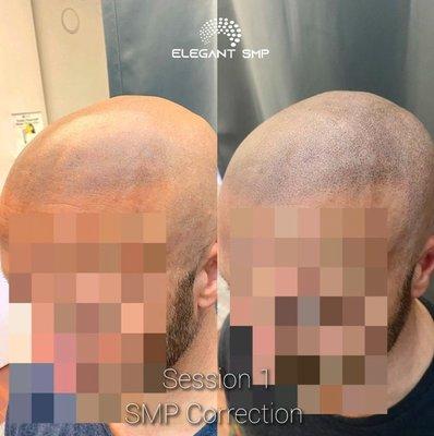 Scalp micropigmentation on a client that had work done somewhere else that left him much to be desired. We're located in Buffalo, NY.