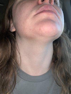 The left side while looking at the picture of my chin is a thick patch of hair and my upper lip.