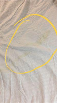 Urine stains on bed sheet