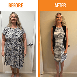 Charleston Weight Loss