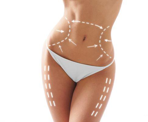 Advanced Body Contouring, Slimming & Cellulite Treatments.