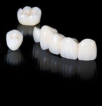 Dental Crown: Starting at  $950