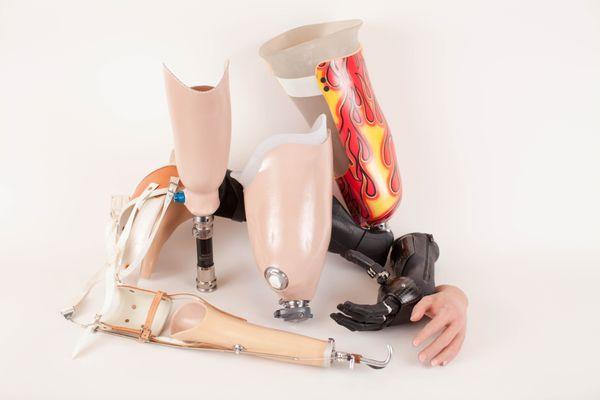 Winkley Upper & Lower Limb Prostheses