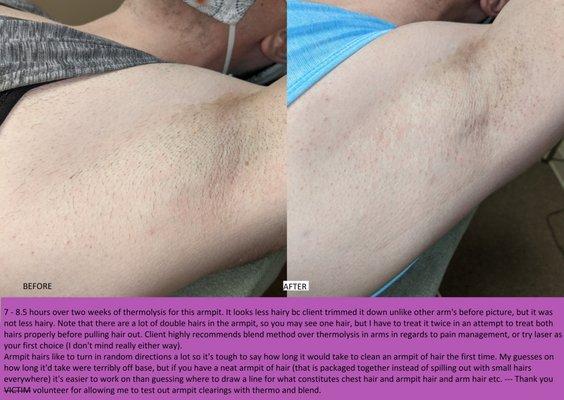 Client has left armpit hair removed, description on bottom of picture describing it all.