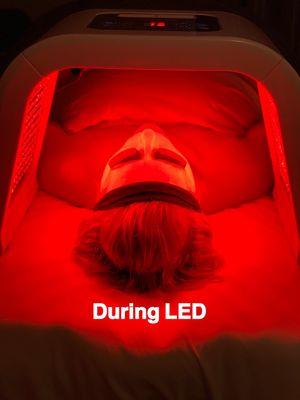 LED comes with certain facials or can be an add on service.