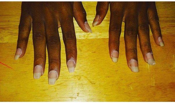 After && before! Foundation is key, even with acrylic your nails should still look natural!