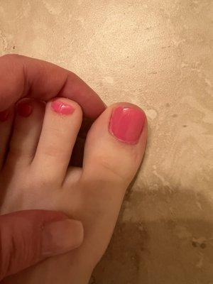 Terrible pedicure