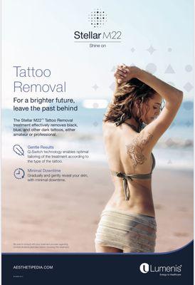 Tattoo Removal Treatment