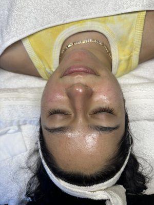 Immediately after our Glass Skin HydraFacial. Glowing!