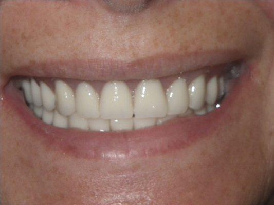 Venetian Smile Denture Lab