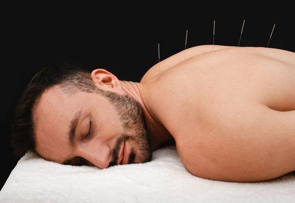 Acupuncture triggers your body to release your own natural pain Also treats anxiety, depression, insomnia, back pain, neck pain, migraines.