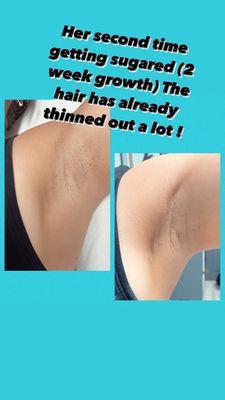 Results from sugaring