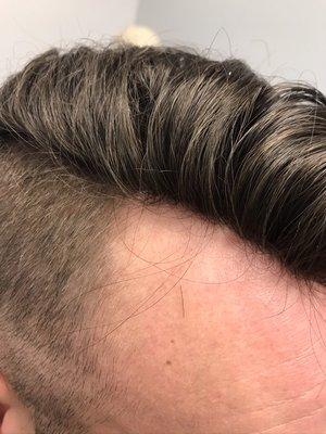 Men's hair replacement is very natural looking now!