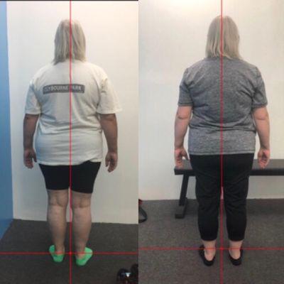 Before and after Egoscue corrective exercise and postural program