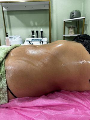 One session of cavitation and lymphatic drainage