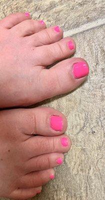 Toenails