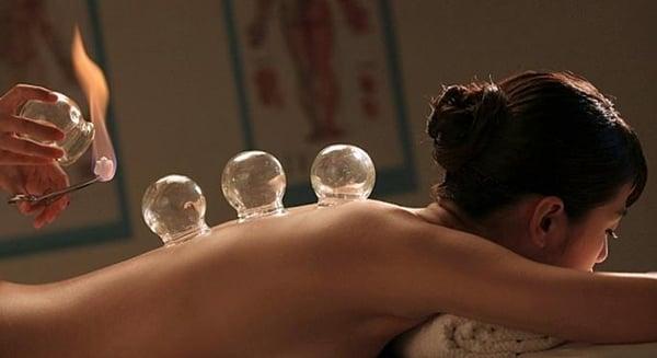 massage cupping