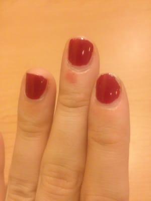 Five days after manicure...