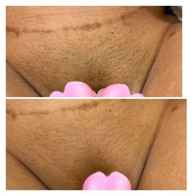 Brazilian Wax