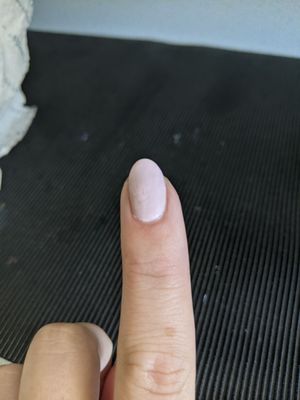 The more days that go by, the worse my nails get