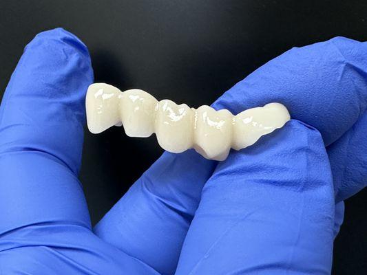 Zirconia 5 Unit Bridge