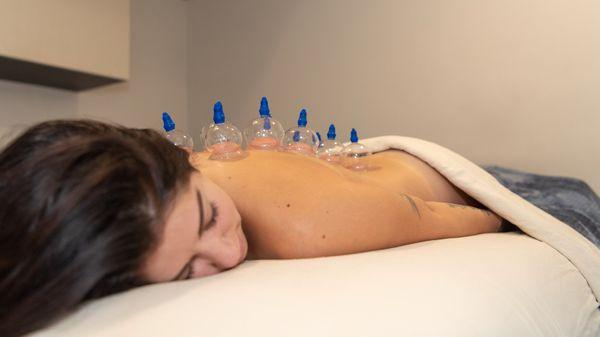 Massage Cupping