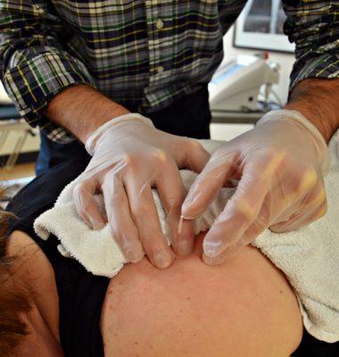 Dee PT offers Dry Needling as well!