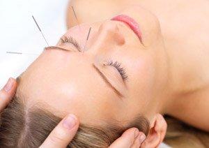 Acupuncture is a method of encouraging the body to promote natural healing and to improve functioning.