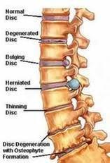 Garland Spine Center