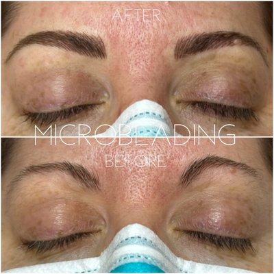 Permanent Makeup Brows using the Microblading technique