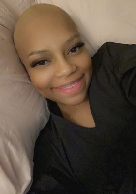 After losing all my hair to chemo. THANK YOU EASTERN OB/GYN IT COULD HAVE ALL BEEN AVOIDED HAD YOU NOT IGNORED THE ABNORMALITIES