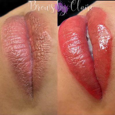 Lip Blush/Lip Neutralization