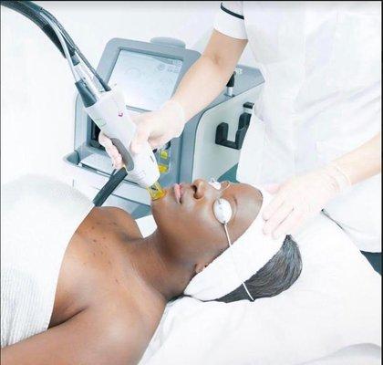 Laser Hair Removal