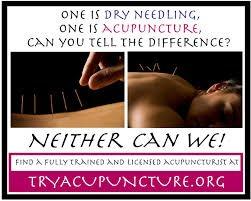 Dry Needling is a very effective style for sports acupuncture.  Dr. Terence is highly skilled in this technique.