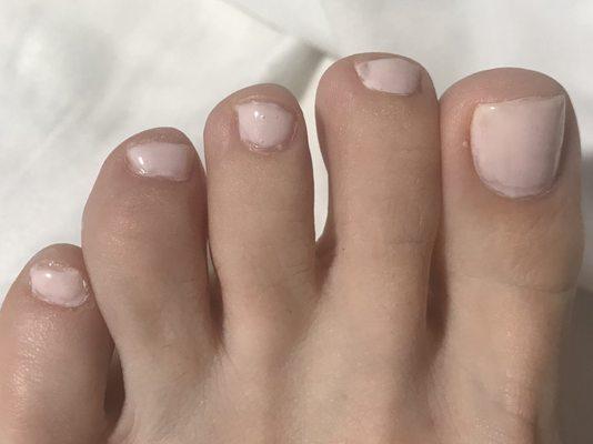 Not a sexy pedi.