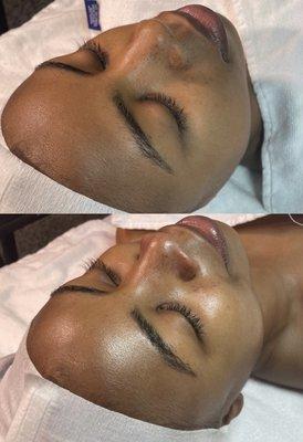 Reset, rebalance, and rehydrate your skin with an Essential 60 Minute Facial. Our most popular facial focused on hydration and circulation.