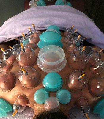 YoRei Life Cupping Therapy