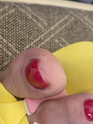 Worse pedicure I had in my life and I m 46