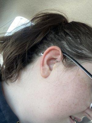 Picture of R ear Daith