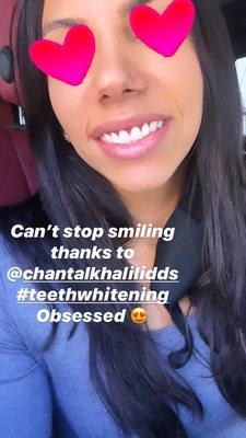 Teeth whitening, gum contour