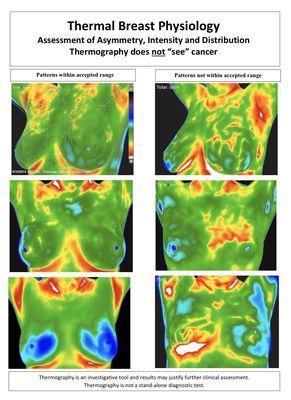 Sozo Thermography