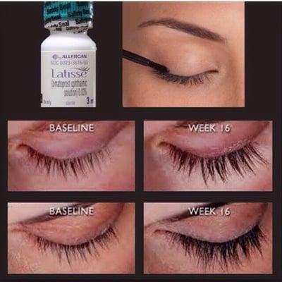 Do you want LONGER, THICKER, DARKER LASHES by Christmas? Call  Crystal Richey, RN/Injector Aesthetic Nurse Specialist.