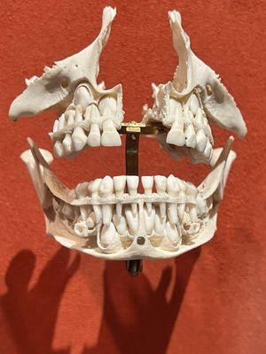 Child's mouth. See the baby teeth and under it the adult teeth.