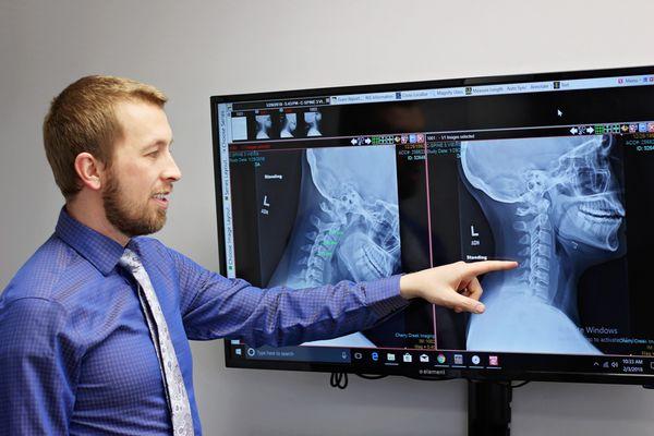 Denver Chiropractor Explains X-Ray Findings to Patient