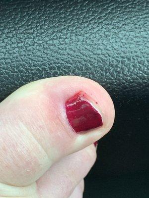 Nail polish on the toes and awful job at shaping the nail